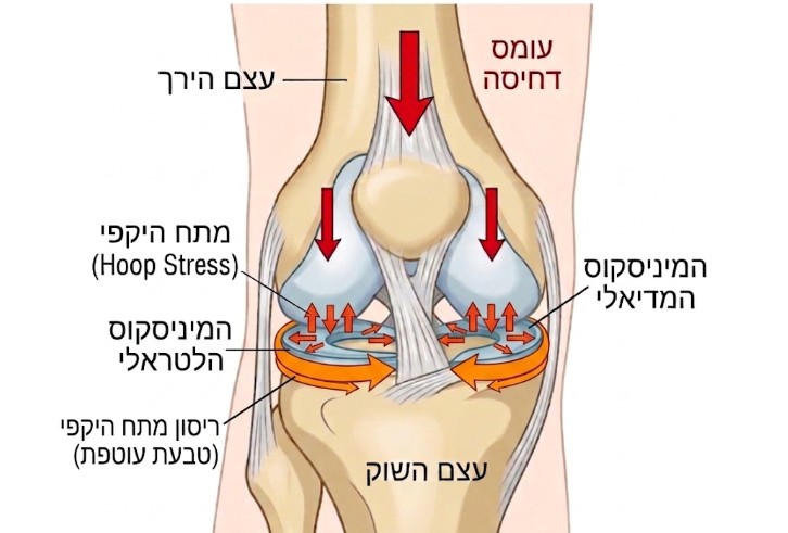 איור המציג עומסי דחיסה ומתח היקפי (Hoop Stress) במיניסקוס בברך